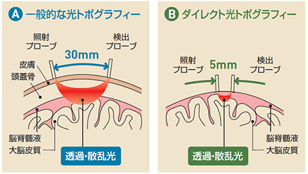 光トポグラフィーの計測イメージ
